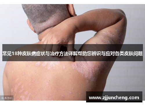 常见18种皮肤病症状与治疗方法详解帮助您辨识与应对各类皮肤问题