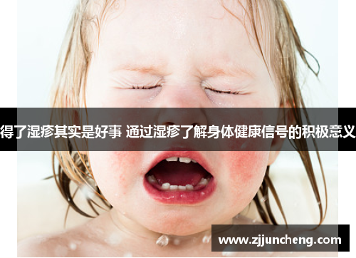 得了湿疹其实是好事 通过湿疹了解身体健康信号的积极意义